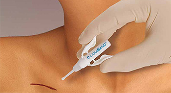 RESORBA Medical