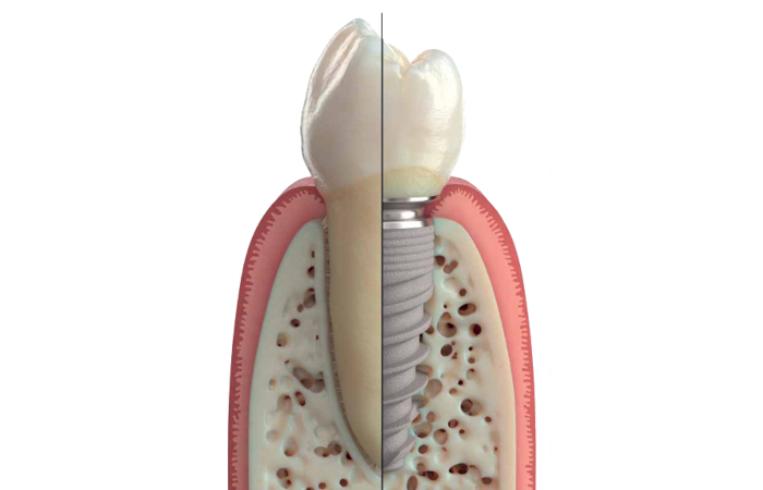 GC