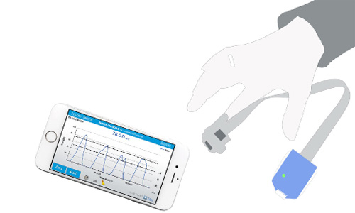 load distribution measurement systems