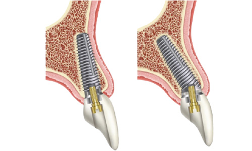 Dental